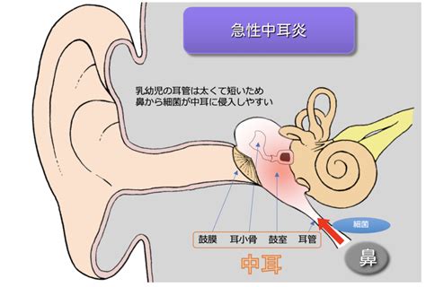 耳熱|急性中耳炎の症状は耳の痛み・発熱・耳だれ｜尼崎市 